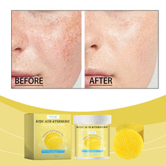 Turmeric Kojic Acid Cleansing Gasket Face Daily Cleaning